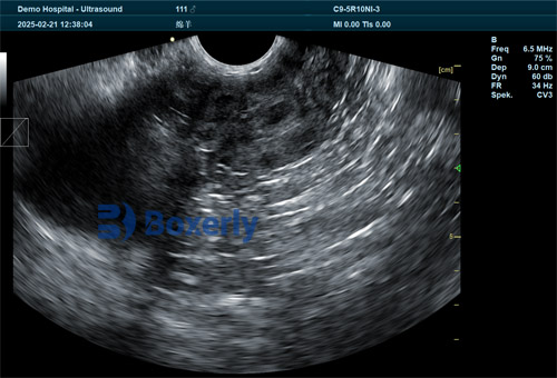 Veterinary Ultrasound Machines: Portable Scanners for Sale(图5)