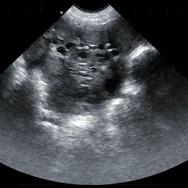 Large convex probe measuring pig follicles